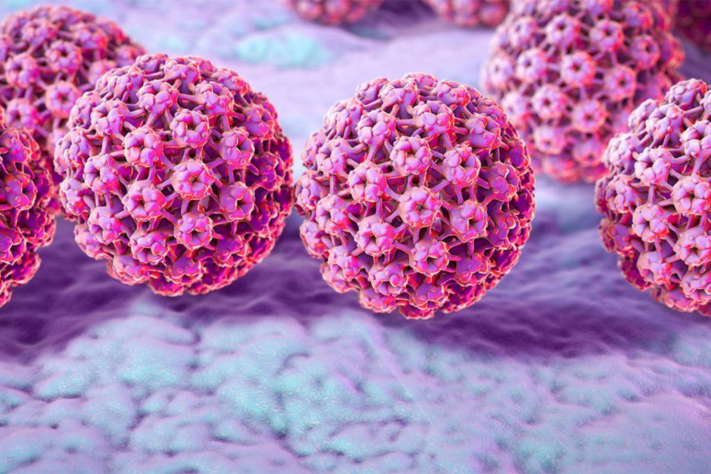 زگیل تناسلی