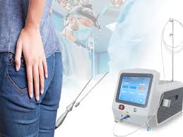 عمل بواسیر با لیزر در تهران