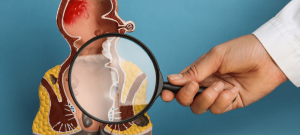 بهترین کلینیک جراحی بواسیر با لیزر در تهران